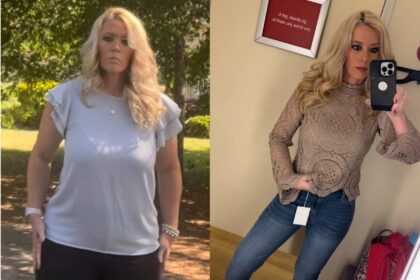A woman who lost 62 pounds on Ozempic says the