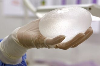 National Breast Implant Registry much needed, but