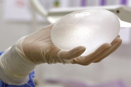 National Breast Implant Registry much needed, but
