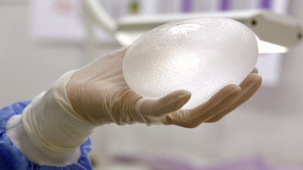 National Breast Implant Registry much needed, but