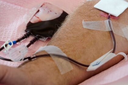 FDA drops specific restrictions on blood donation