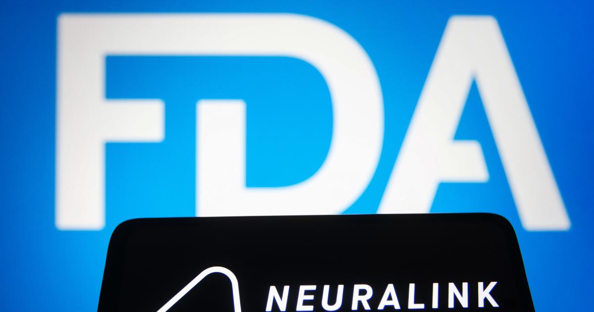 Neuralink receives FDA clearance to begin human